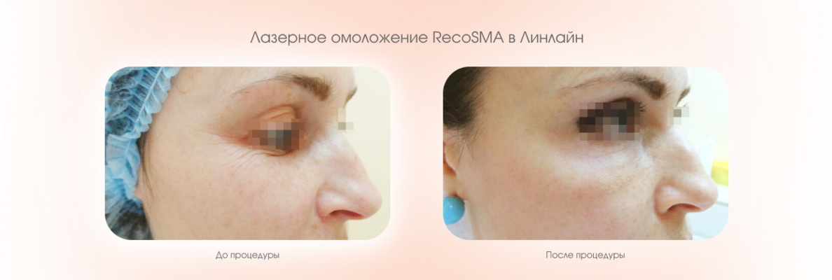 d41c6b09-3d5f-44b8-9b84-7c6798f72c98.png